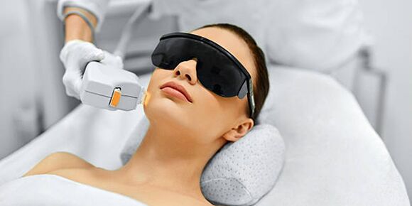 Laser huidverjongingsprocedure